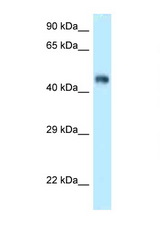 FBXL3 antibody LS-C145919 Western blot of Mouse Kidney lysate. Antibody concentration 1 ug/ml.