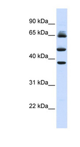 FBXL3 antibody LS-C110757 Western blot of Fetal Liver lysate.