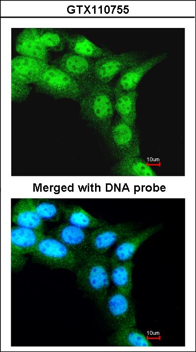 Immunofluorescence of paraformaldehyde-fixed A431 using FBXL3 antibody at 1:200 dilution.