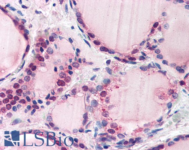 Anti-FBXL3 antibody IHC of human thyroid. Immunohistochemistry of formalin-fixed, paraffin-embedded tissue after heat-induced antigen retrieval. Antibody LS-B2770 concentration 5 ug/ml.