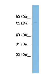 FBXL4 antibody LS-C117060 Western blot of COLO205 cell lysate.