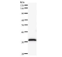 Western blot analysis of immunized recombinant protein, using anti-FBXL4 monoclonal antibody.