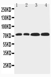 WB of FBXL4 / FBL5 antibody. Lane 1: Rat Liver Tissue Lysate. Lane 2: Rat Lung Tissue Lysate. Lane 3: HELA Cell Lysate. Lane 4: PANC Cell Lysate.