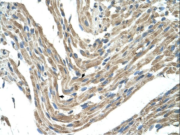 FBXL5 antibody LS-C31926 was used in IHC to stain formalin-fixed, paraffin-embedded human muscle.
