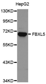 Western blot analysis of extracts of HepG2 cell line, using FBXL5 antibody.