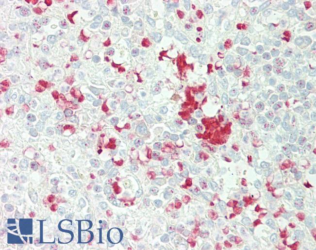 Anti-FBXL5 / FBL5 antibody IHC staining of human spleen. Immunohistochemistry of formalin-fixed, paraffin-embedded tissue after heat-induced antigen retrieval.