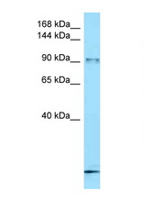 FBXO11 antibody LS-C146331 Western blot of Small Intestine lysate. Antibody concentration 1 ug/ml.
