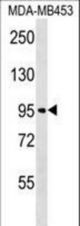 FBXO11 Antibody western blot of MDA-MB453 cell line lysates (35 ug/lane). The FBXO11 antibody detected the FBXO11 protein (arrow).