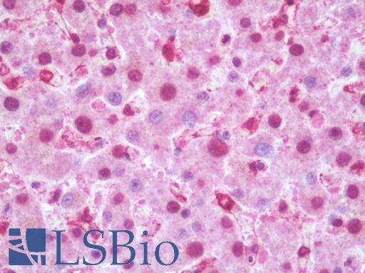 Anti-CNRIP1 antibody IHC staining of human liver. Immunohistochemistry of formalin-fixed, paraffin-embedded tissue after heat-induced antigen retrieval.
