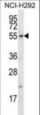 FBXO15 Antibody western blot of NCI-H292 cell line lysates (35 ug/lane). The FBXO15 antibody detected the FBXO15 protein (arrow).