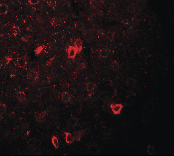 Immunofluorescence of CNRIP1 in rat brain tissue with CNRIP1 antibody at 20 ug/ml.