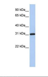 Hela cell lysate. Antibody concentration: 1.0 ug/ml. Gel concentration: 12%.
