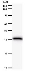 Western blot of immunized recombinant protein using FBXO18 antibody.