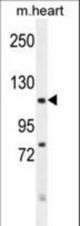 FBXO18 Antibody western blot of mouse heart tissue lysates (35 ug/lane). The FBXO18 antibody detected the FBXO18 protein (arrow).