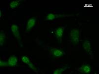 Immunostaining analysis in HeLa cells. HeLa cells were fixed with 4% paraformaldehyde and permeabilized with 0.1% Triton X-100 in PBS. The cells were immunostained with anti-FBXO18 mAb.