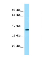 FBXO2 antibody LS-C146329 Western blot of Small Intestine lysate. Antibody concentration 1 ug/ml.