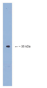 WB: 1.0 g/mL on mouse brain lysate.