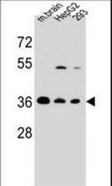 FBXO2 Antibody western blot of mouse brain tissue and HepG2,293 cell line lysates (35 ug/lane). The FBXO2 antibody detected the FBXO2 protein (arrow).