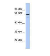 Western blot of Human OVCAR-3. FBXO21 antibody dilution 1.0 ug/ml.