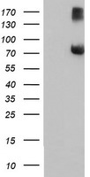 HEK293T cells were transfected with the pCMV6-ENTRY control (Left lane) or pCMV6-ENTRY FBXO21 (Right lane) cDNA for 48 hrs and lysed. Equivalent amounts of cell lysates (5 ug per lane) were separated by SDS-PAGE and immunoblotted with anti-FBXO21.