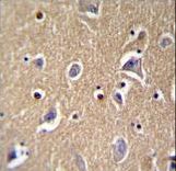 FBXO21 Antibody immunohistochemistry of formalin-fixed and paraffin-embedded human brain tissue followed by peroxidase-conjugated secondary antibody and DAB staining.