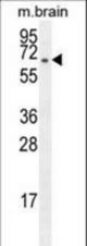 FBXO21 Antibody western blot of mouse brain tissue lysates (35 ug/lane). The FBXO21 antibody detected the FBXO21 protein (arrow).
