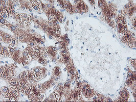 IHC of paraffin-embedded Human liver tissue using anti-FBXO21 mouse monoclonal antibody. (Heat-induced epitope retrieval by 10mM citric buffer, pH6.0, 100C for 10min).