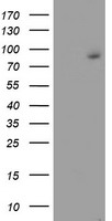 HEK293T cells were transfected with the pCMV6-ENTRY control (Left lane) or pCMV6-ENTRY FBXO21 (Right lane) cDNA for 48 hrs and lysed. Equivalent amounts of cell lysates (5 ug per lane) were separated by SDS-PAGE and immunoblotted with anti-FBXO21.