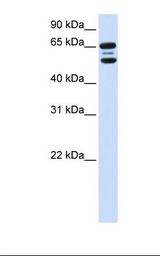 293T cell lysate. Antibody concentration: 1.0 ug/ml. Gel concentration: 12%.