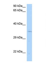 CNTD1 / CNTD antibody LS-C146344 Western blot of Rat Brain lysate. Antibody concentration 1 ug/ml.