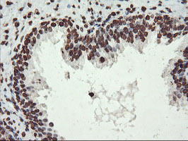 IHC of paraffin-embedded Human prostate tissue using anti-FBXO21 mouse monoclonal antibody.