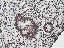 IHC of paraffin-embedded Human endometrium tissue using anti-FBXO21 mouse monoclonal antibody.