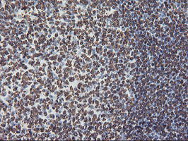 IHC of paraffin-embedded Human tonsil using anti-FBXO21 mouse monoclonal antibody.