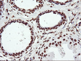 IHC of paraffin-embedded Human breast tissue using anti-FBXO21 mouse monoclonal antibody.