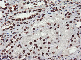 IHC of paraffin-embedded Human Kidney tissue using anti-FBXO21 mouse monoclonal antibody.