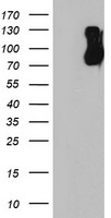 HEK293T cells were transfected with the pCMV6-ENTRY control (Left lane) or pCMV6-ENTRY FBXO21 (Right lane) cDNA for 48 hrs and lysed. Equivalent amounts of cell lysates (5 ug per lane) were separated by SDS-PAGE and immunoblotted with anti-FBXO21.