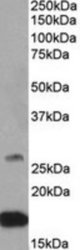 CNTF antibody (0.5 ug/ml) staining of Mouse Brain lysate (35 ug protein/ml in RIPA buffer). Primary incubation was 1 hour. Detected by chemiluminescence.