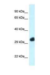 FBXO22 antibody LS-C145712 Western blot of Mouse Heart lysate. Antibody concentration 1 ug/ml.