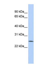 FBXO22 antibody LS-C102570 Western blot of HepG2 cell lysate.