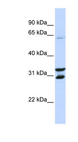 FBXO24 antibody LS-C110758 Western blot of Jurkat lysate.