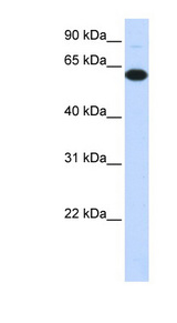 FBXO24 antibody LS-C102026 Western blot of Transfected 293T cell lysate.