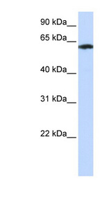 FBXO24 antibody LS-C110782 Western blot of Transfected 293T cell lysate.