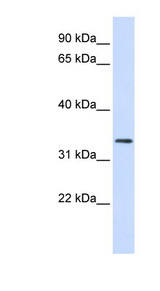 FBXO25 antibody LS-C102002 Western blot of Fetal Heart lysate.