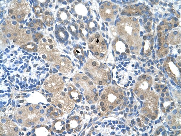 FBXO25 antibody LS-C31927 was used in IHC to stain formalin-fixed, paraffin-embedded human kidney.