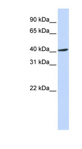 FBXO28 antibody LS-C102596 Western blot of MCF7 cell lysate.
