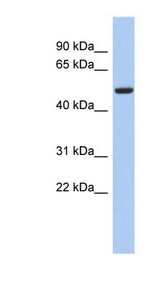 FBXO3 antibody LS-C110760 Western blot of Fetal Small Intestine lysate.