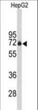 Western blot of FBXO3 Antibody in HepG2 cell line lysates (35 ug/lane). FBXO3 (arrow) was detected using the purified antibody.
