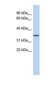 FBXO31 antibody LS-C111542 Western blot of Fetal Stomach lysate.