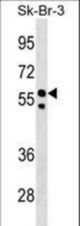 FBXO31 Antibody western blot of SK-BR-3 cell line lysates (35 ug/lane). The FBXO31 antibody detected the FBXO31 protein (arrow).