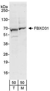 Detection of Human and Mouse FBXO31 by Western Blot. Samples: Whole cell lysate (50 ug) from 293T (T) and mouse NIH3T3 (M) cells. Antibody: Affinity purified rabbit anti-FBXO31 antibody used for WB at 0.4 ug/ml. Detection: Chemiluminescence with an exposure time of 30 seconds.
